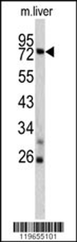 TNFAIP2 Antibody (Center)