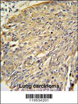 Annexin A1 Antibody (Center)