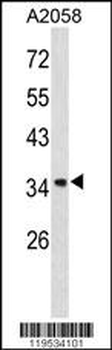 Annexin A1 Antibody (Center)