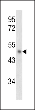PAI2 Antibody (Center)