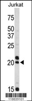 VIP Antibody (C-term)