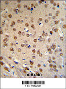 WTX Antibody (Center)