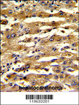 FABP3 Antibody (N-term)