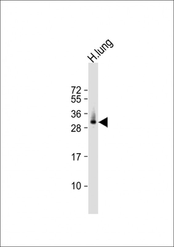 ELOVL6 Antibody (N-term)