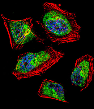 CNOT8 Antibody (C-term)