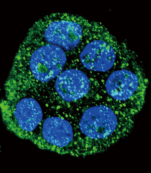 IL1RN Antibody (Center)