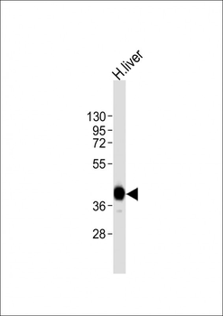 AGXT Antibody (Center)