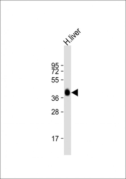 AGXT Antibody (Center)