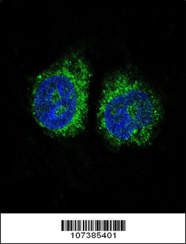 NURR1 (NR4A2) Antibody (N-term)