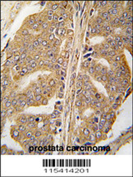 PXN Antibody (Y118)