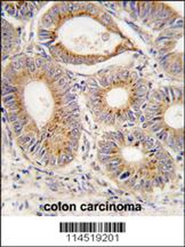 FGF1 Antibody (N-term)