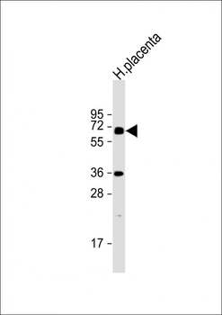 IL1R Antibody (C-term E487)