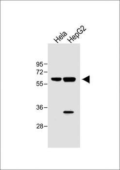 IL1R Antibody (C-term E487)