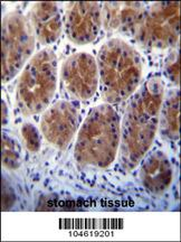 Metabotropic Glutamate Receptor 1 Antibody (C-term)