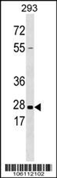 Kallikrein 5 Antibody (Center)