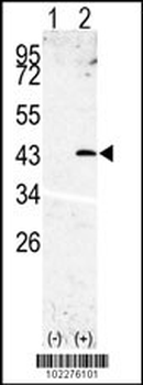 SPPL3 Antibody (N-term)