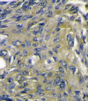 VEGFD (VEGF4) Antibody (C-term)