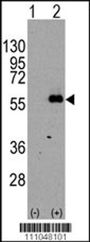 MEF2C Antibody (S396)