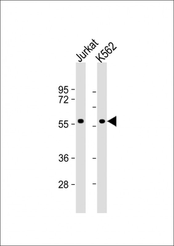 MEF2C Antibody (S396)