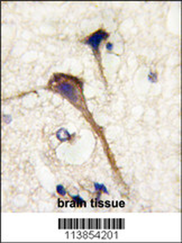 INA (alpha internexin) Antibody (Center)
