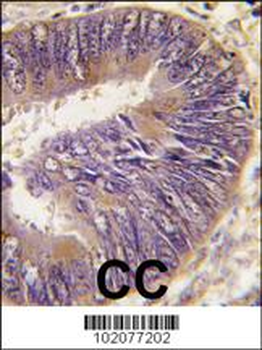 HSC70 Interacting Protein HIP (ST13) Antibody