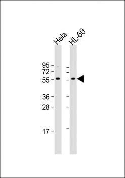Presenilin 1 (PSEN1) Antibody (C-term)