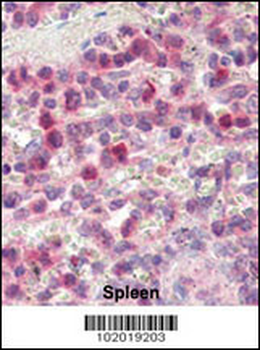 MMP9 Antibody (C-term)