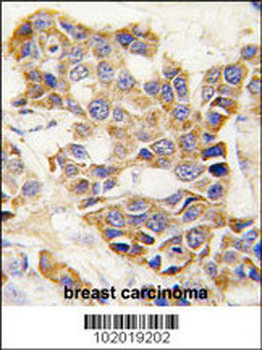 MMP9 Antibody (C-term)