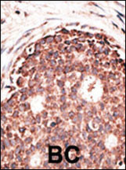MMP9 Antibody (C-term)
