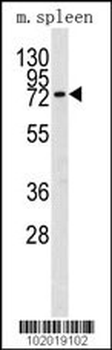 MMP9 Antibody (C-term)