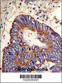 MMP15 Antibody (N-term)