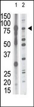 MMP15 Antibody (N-term)
