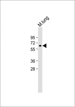 MMP14 Antibody (N-term)