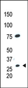 CDX1 Antibody (C-term)