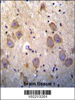 cIAP2 (BIRC3) Antibody (N-term)