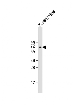 BACE1B Antibody (Center)