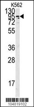 ACE2 (NCOVID/SARS Receptor) Antibody (C-term)