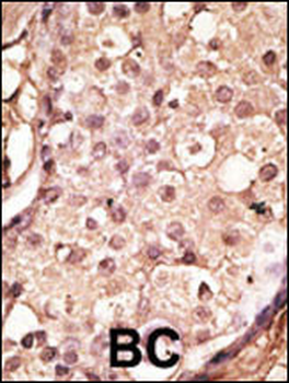 ACE2 (NCOVID / SARS Receptor) Antibody (Center)