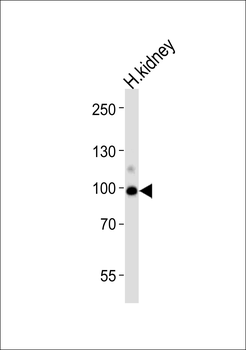ACE2 (NCOVID / SARS Receptor) Antibody (Center)