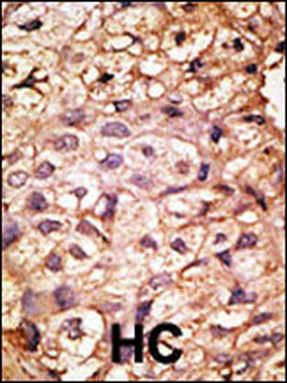 ACE2 (NCOVID / SARS Receptor) Antibody (N-term)