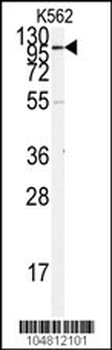 ACE2 (NCOVID / SARS Receptor) Antibody (N-term)