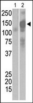 SARS Coronavirus Spike Glycoprotein Antibody