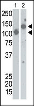SARS Coronavirus Spike Glycoprotein Antibody
