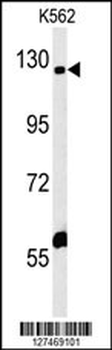 IQSEC3 Antibody (N-term)