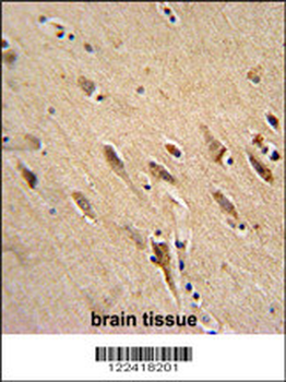 ARF1 Antibody (Center)