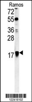 ARF1 Antibody (Center)