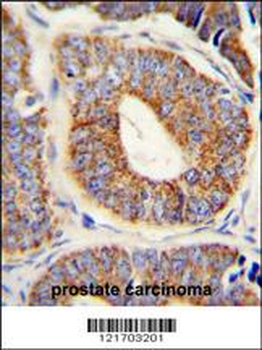 DNAJA1 Antibody (Center)