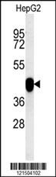 PON2 Antibody (Center)
