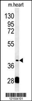 PON2 Antibody (Center)