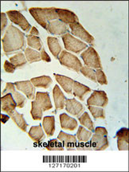 LDHD Antibody (N-term)